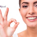 Pasos a seguir tras el tratamiento de Ortodoncia